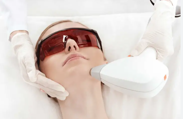 IPL skin rejuvenation treatment machine